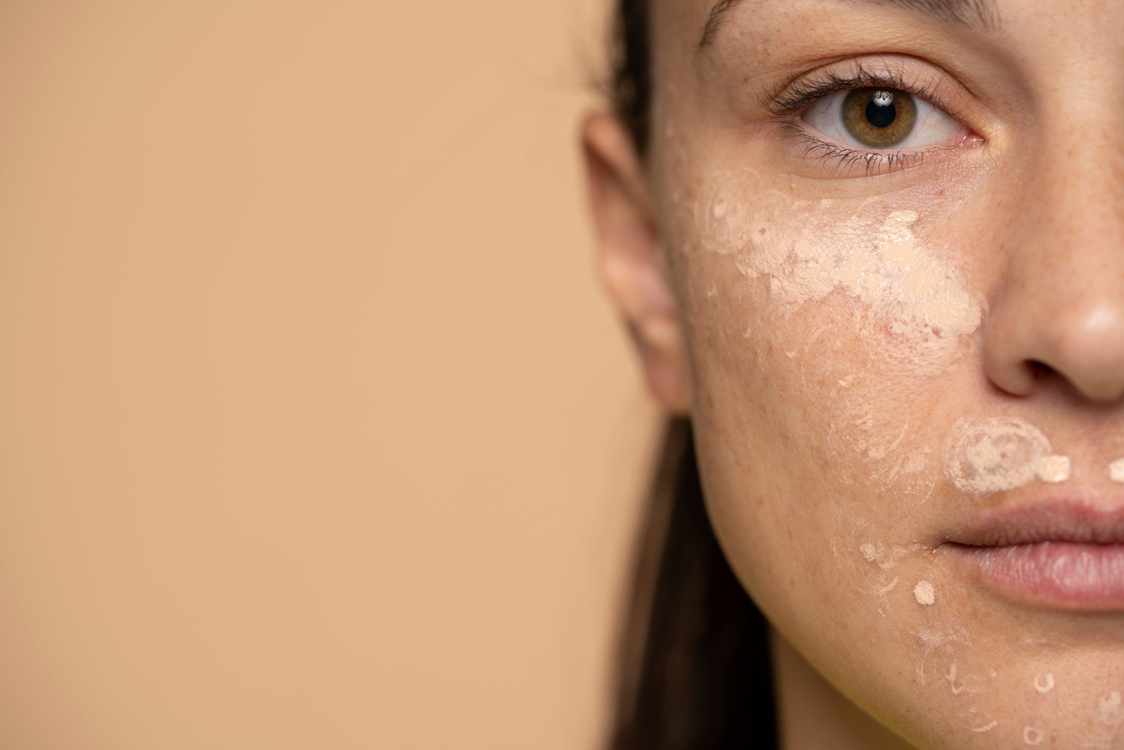 Best Cream Concealers for Flawless Coverage